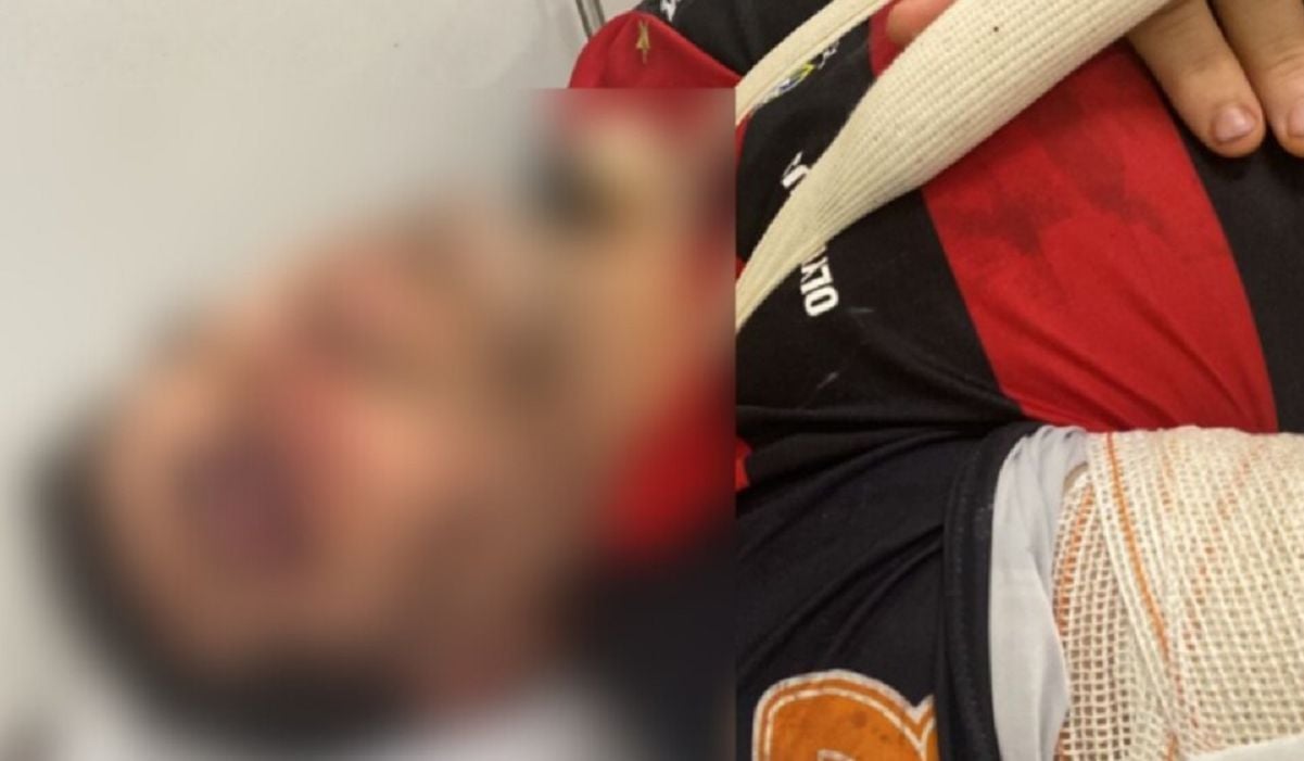 Flamengo fan suffered head trauma after being beaten in bar