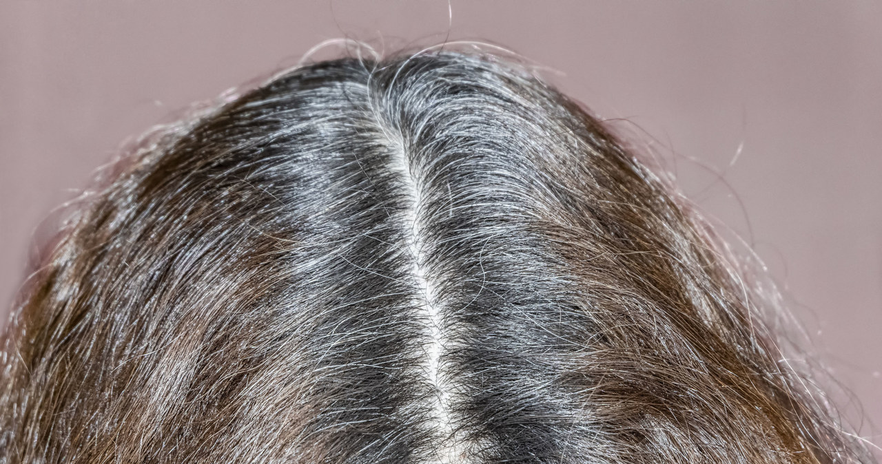 When the first gray hair appears, you do not need to dye your hair. There are other ways to deal with white strands. /123RF/PICSEL