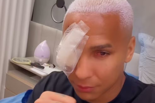 Striker Deyverson underwent eye surgery