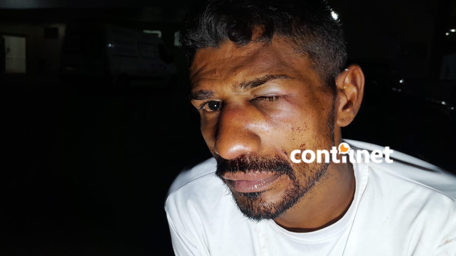 Man is attacked and has cell phone stolen in front of the Rio Branco Police Station