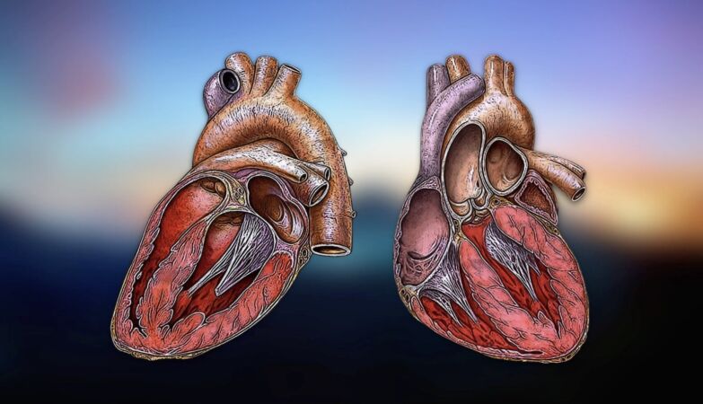 The curious case of the man with two hearts – and what happened when they both stopped working