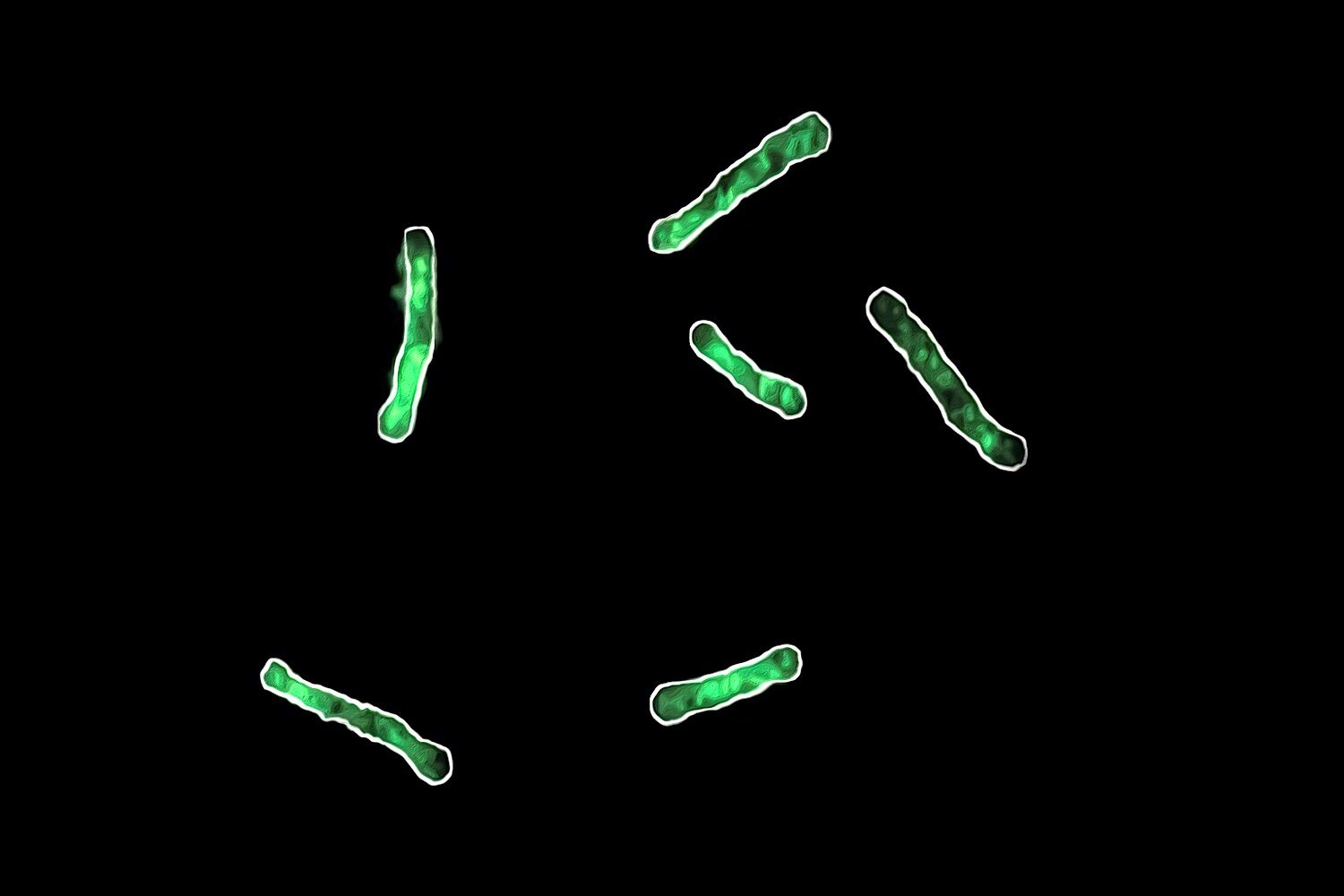 Scientists say they have found the Achilles heel of super-resistant bacteria