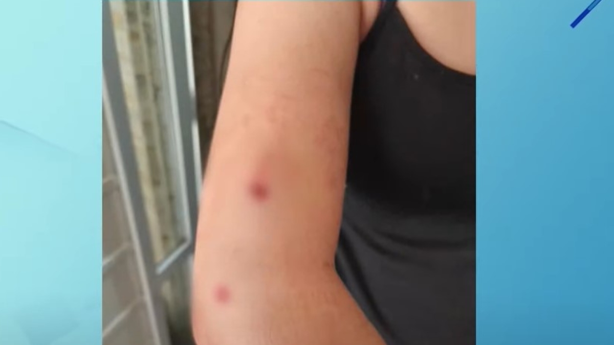 A teenager living in Curitiba was shot in the arm during the New Year's Eve fireworks display in Copacabana, Rio de Janeiro. Bárbara Beraldo, 14 years old, was close to the water when she felt the impact: "I even looked back thinking it was a joke"he said. The girl is doing well after receiving care at Hospital Souza Aguiar.