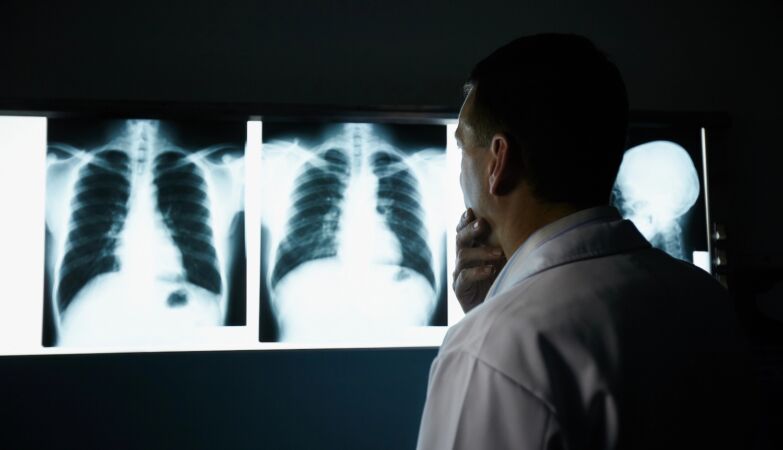 Why is lung cancer increasing in non -smokers?