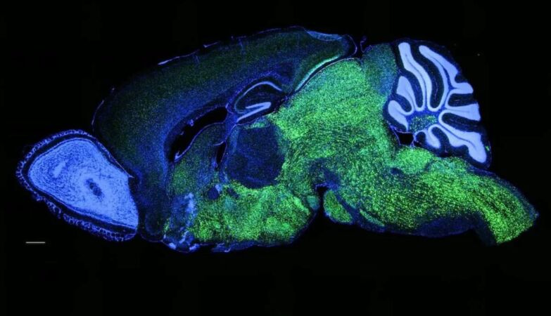 The genetic discovery that can explain the origin of human language: a protein that modifies vocalization