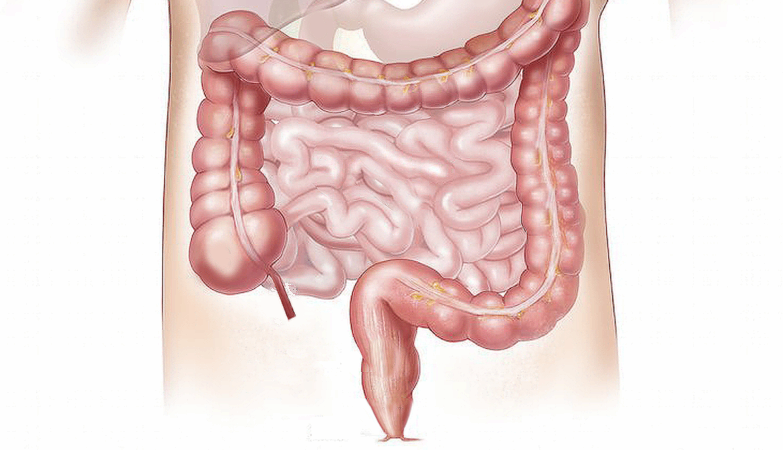 Scientist creates intestinal health calculator (very easy to use)