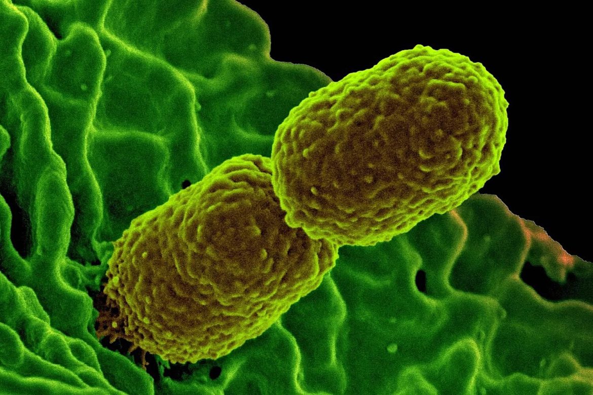Portugal cannot lock multi -resistant superbacteria. Program that does it Portugal cannot lock multi -resistant superbacteria. Program that does it has no director