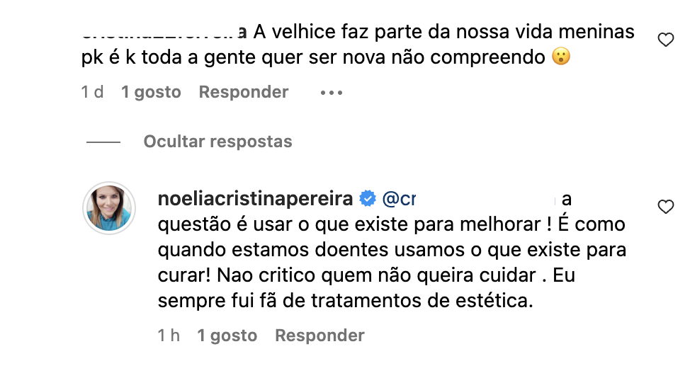 “ Old age is part ”. Noélia Pereira responds to criticism after aesthetic procedure