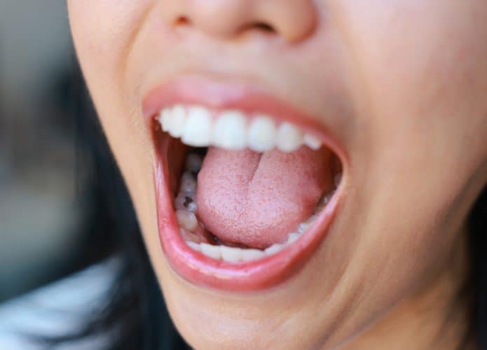 Electronic cigarette increases caries risk and alters teeth