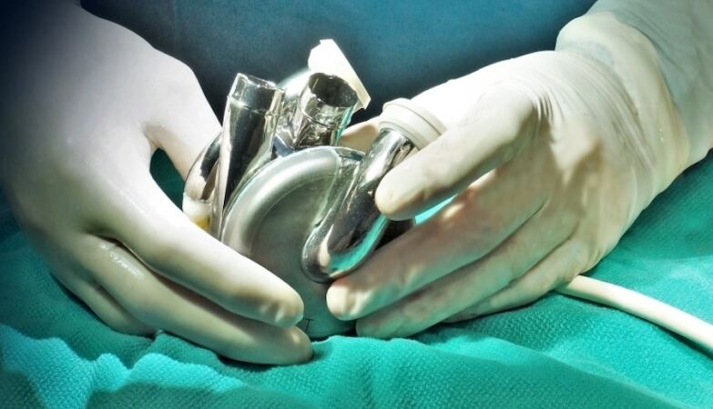 Australian survived 100 days with artificial heart