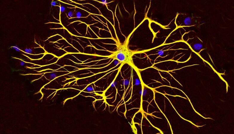 Scientists discover brain cell type never seen before