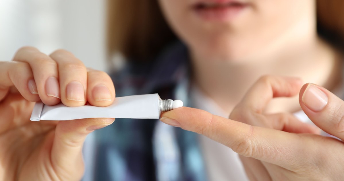 Zinc ointment is best applied to the skin. /123RF/PICSEL