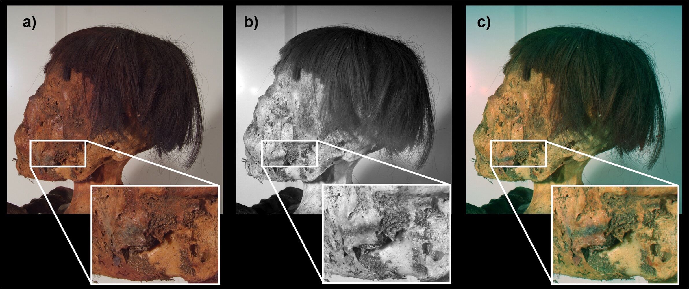 Rare facial tattoos found in a strange Andean mummy with 800 years