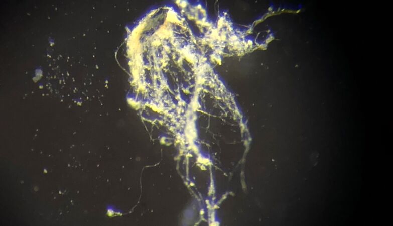 Scientists discover organism that acts as a living electrical cable