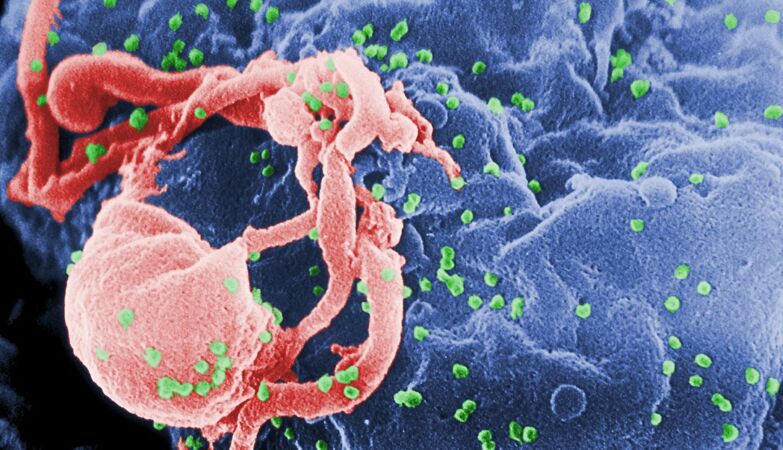 Adn Viking suggests that the genetic mutation that fights HIV has emerged 9,000 years ago with the Black Sea