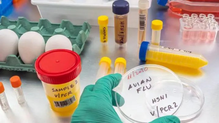 Laboratory bench with H5N1 influenza detection equipment