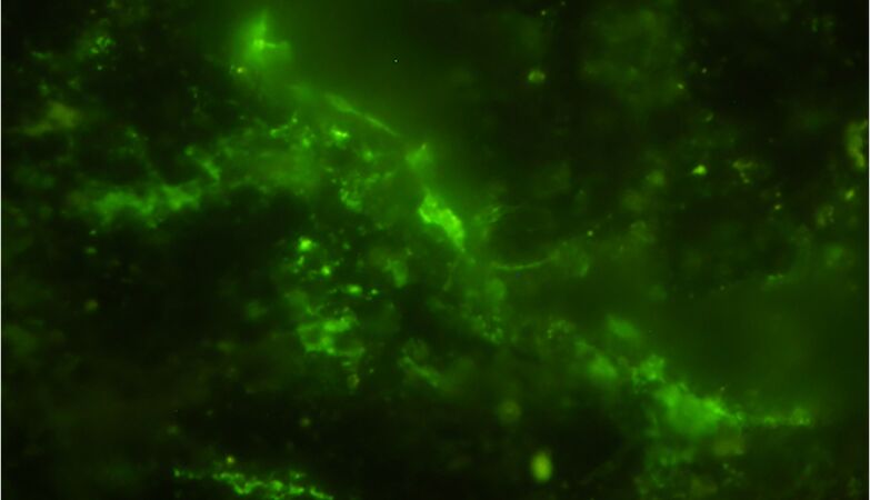 Strange microbes found in China give new clues about the ancestor of all complex life
