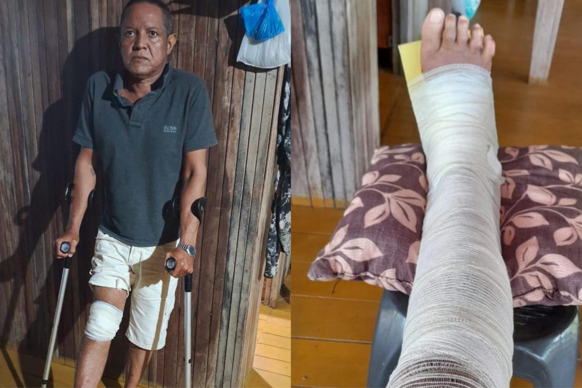 Resident of Sena Madureira fracture the leg in accident and asks for help in maintaining