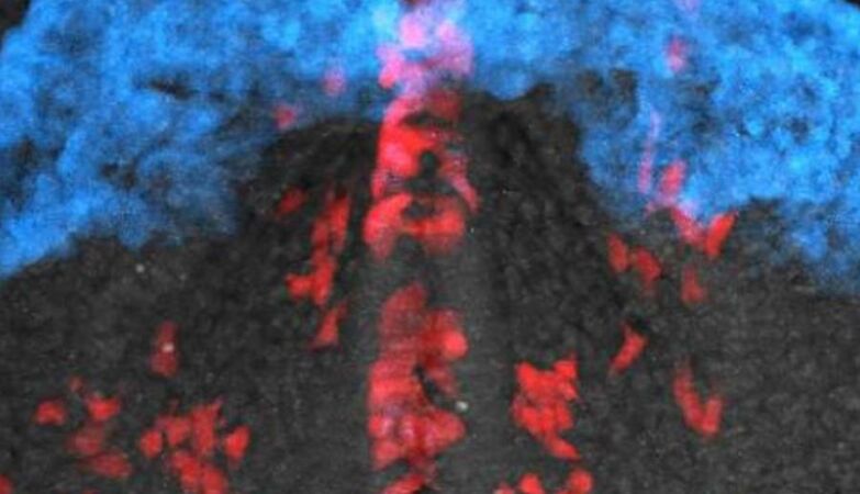 Cardiac Dance: Video shows cells to form a heart
