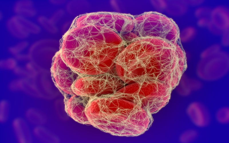 How to Find out if a blood clot was formed: 7 warning signs
