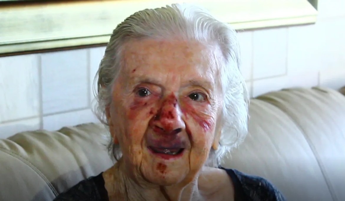 “I handed his life to God,” says 93 -year -old elderly woman thrown on the ground in robbery