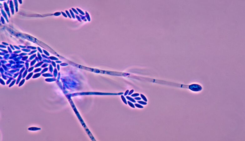 Vomotes, injuries, infertility. Chinese fungus possibly “agroterrorist” in the US, warns FBI