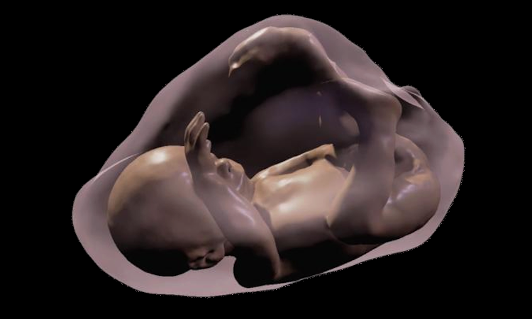 Obesity mothers can trigger permanent liver damage in babies