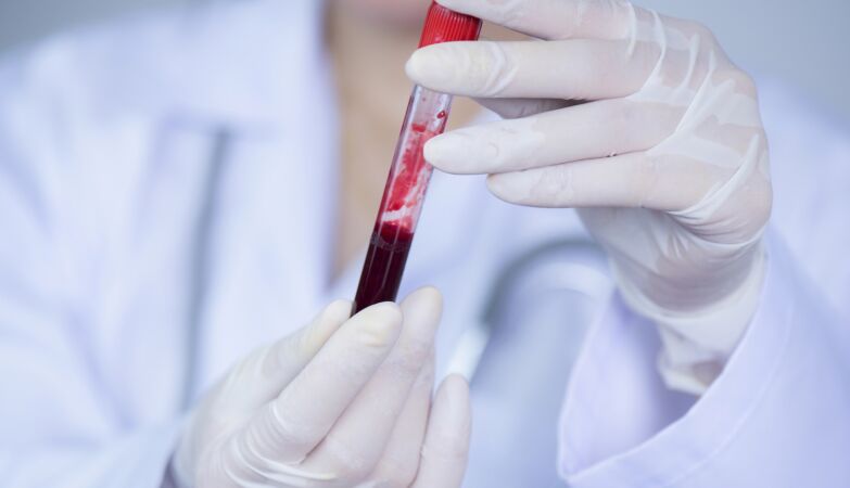 Discovered new blood type: negative Gwada