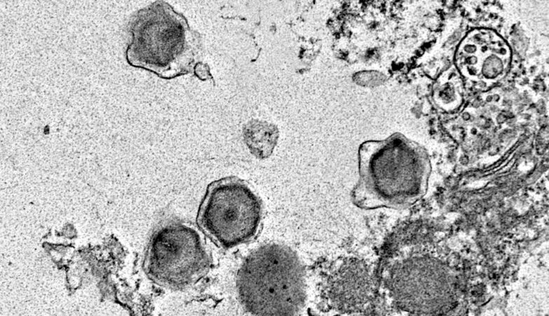Discovered 230 new giant viruses. It's good news