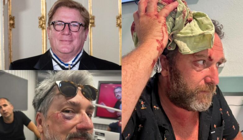 Wheelchair Herman, Markl with Black Eye, Eduardo Madeira opened his head. “Malta da Comedy, something goes on”