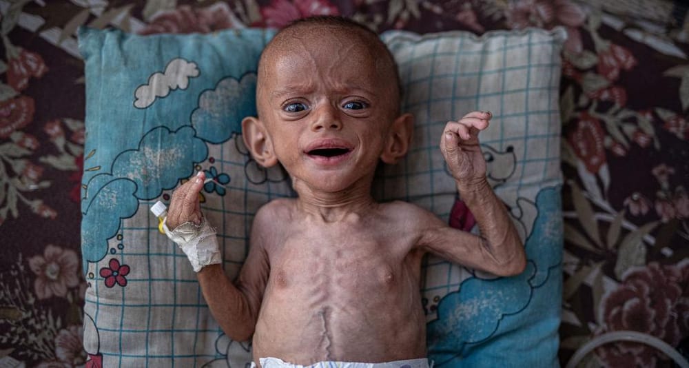 Trump belies Netanyahu: "There is hunger in Gaza, you can't pretend." And Israel guilt (besides Hamas)
