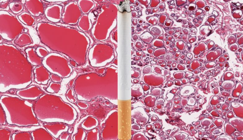Tobacco ages the whole body - irreversibly