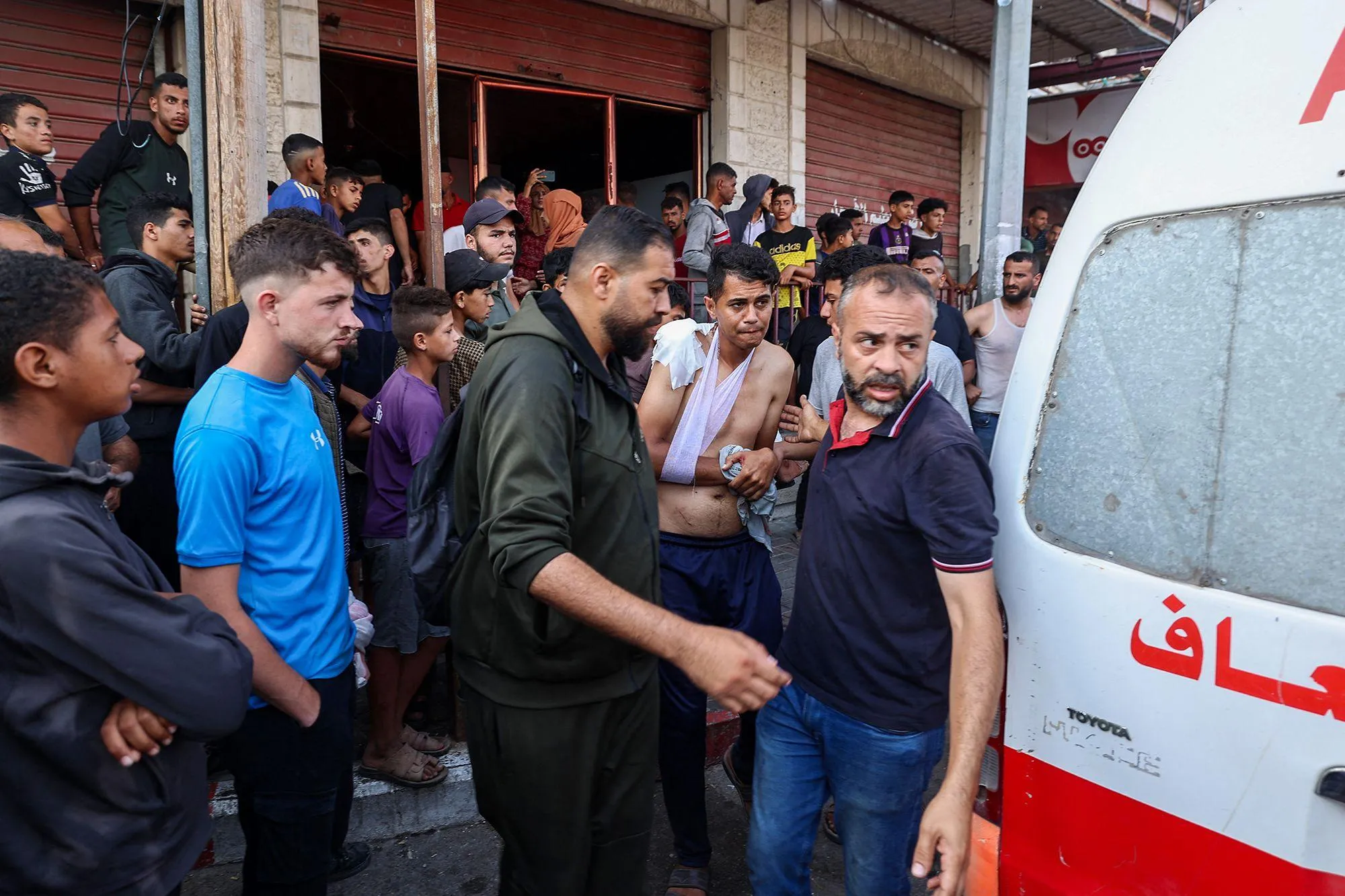 Four -year -old girl starving in Gaza while Israel restricts food supply