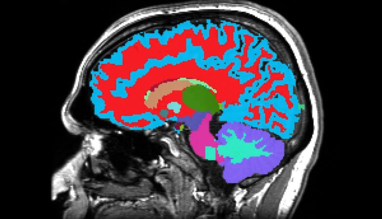 New tool reads the brain's hidden clock and predicts dementia decades before