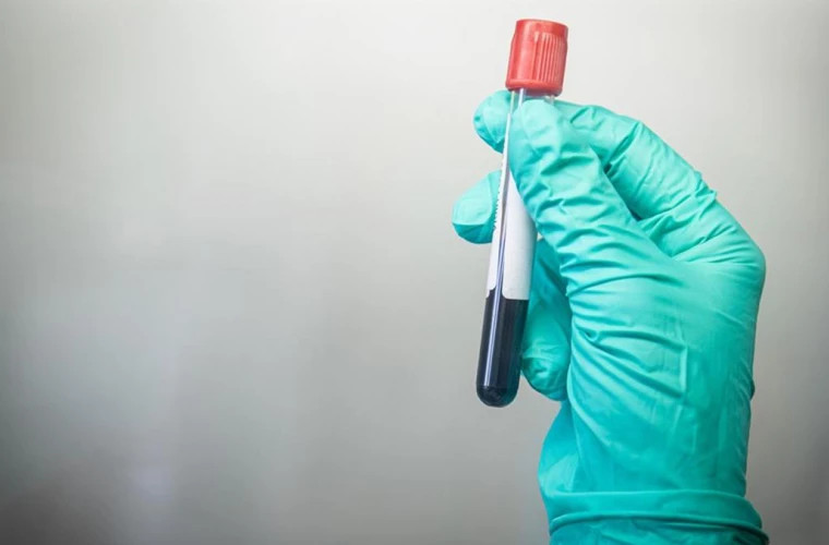 In India, doctors have discovered a new type of blood group unknown so far