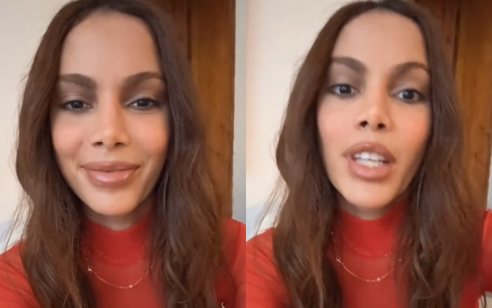 Anitta denies “disfigured” face rumors after aesthetic procedure