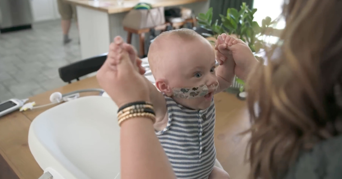 Most premature baby in the world was 1 year: he was born with 285g and won all the odds