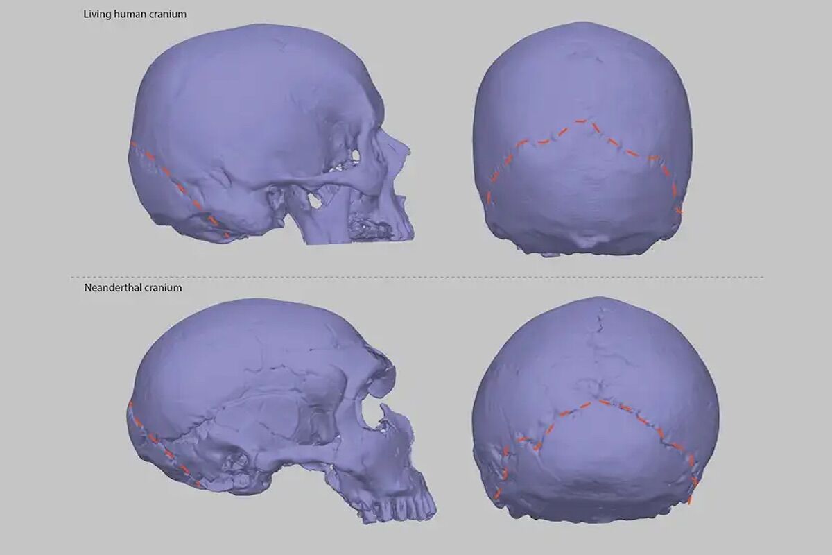 "Neanderthal" skulls can explain the reason for many headaches