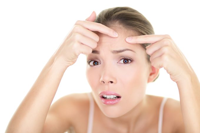 Treatment of acne