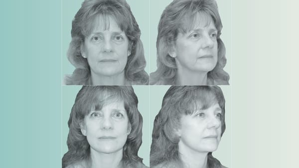 They took Ozepic, lost weight, but they looked older: "Skin sagging, encouraged appearance, all half hanging and flabby."