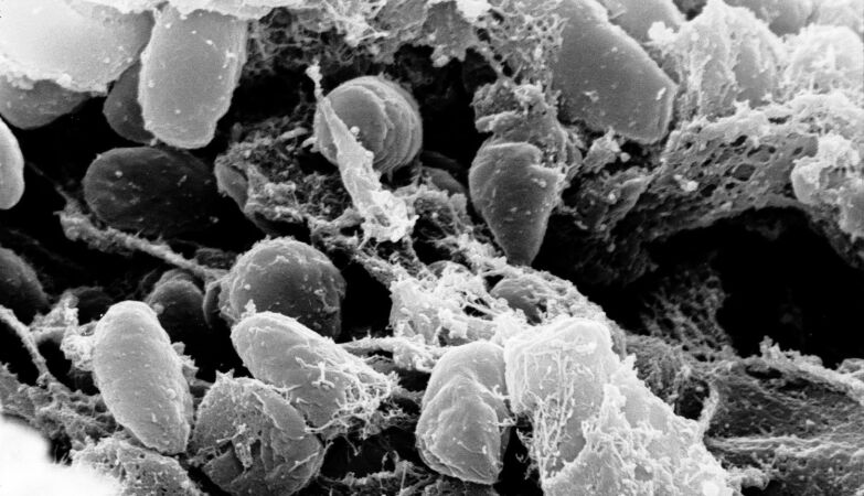 Prehistoric plague jumped from unknown species to sheep-and then humans