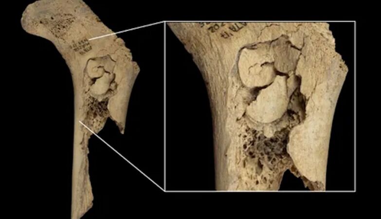 Bones found in Spain show signs of ancient cannibalism that decimated family of 11 people