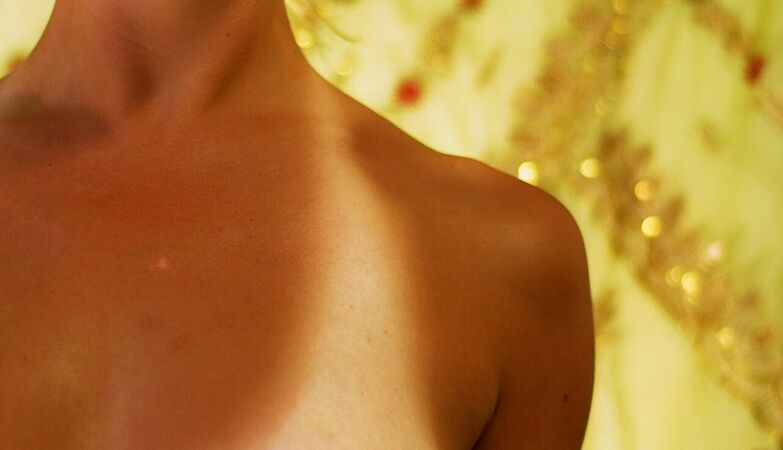 Picking up scalders to have tan marks is fashionable. France “burns” tiktok