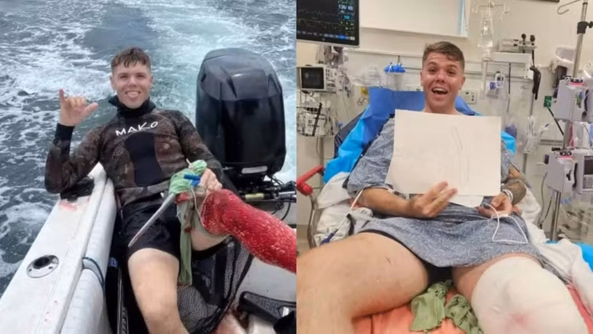 Smile in danger: Blood -covered fisherman Viralizing after shark attack