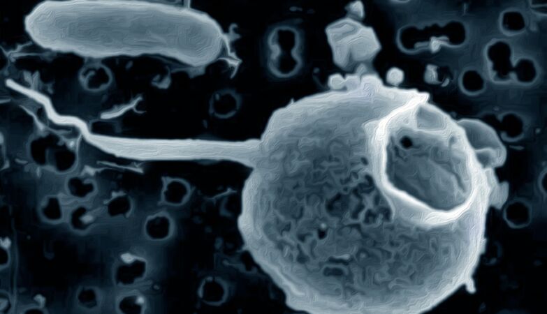Discovered giant virus in the Pacific - with the longest tail ever seen