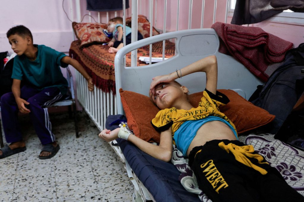 Gaza: What does it really mean to die of hunger?