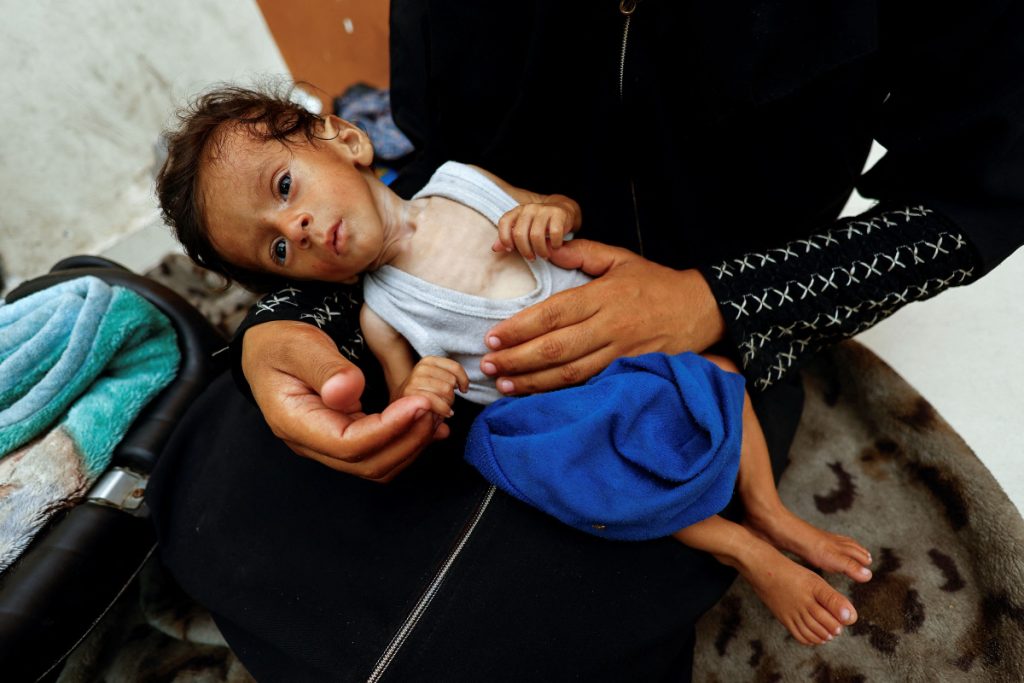 Gaza: What does it really mean to die of hunger?