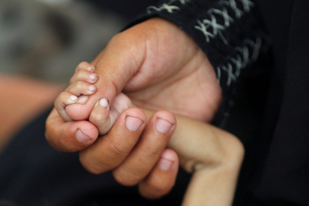 Gaza: What does it really mean to die of hunger?