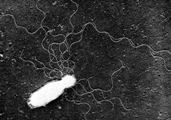 Strange new bacteria found in the Amazon
