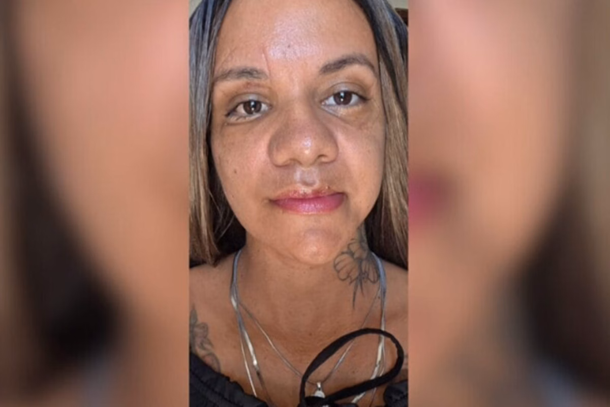 Batured woman with 61 punches shows results of facial reconstruction